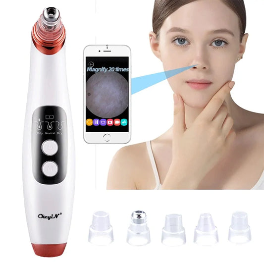 The Blackhead Remover Pro