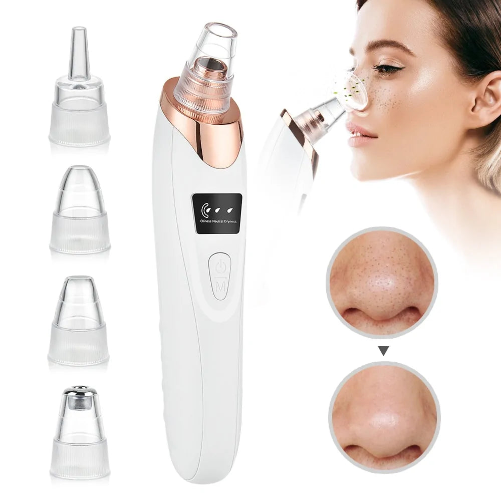 The Blackhead Remover