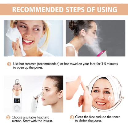 The Blackhead Remover